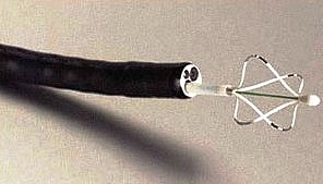 RECOMENDA��ES PARA TERMOPLASTIA BR�NQUICA EM ASMA DE DIF�CIL CONTROLE: FA�A O DOWNLOAD